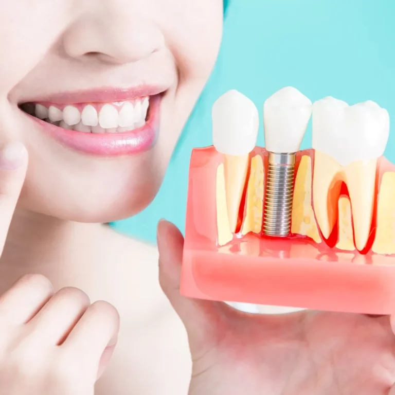 woman take tooth implant false tooth