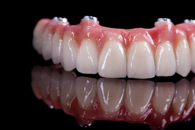 implant-supported denture on black background