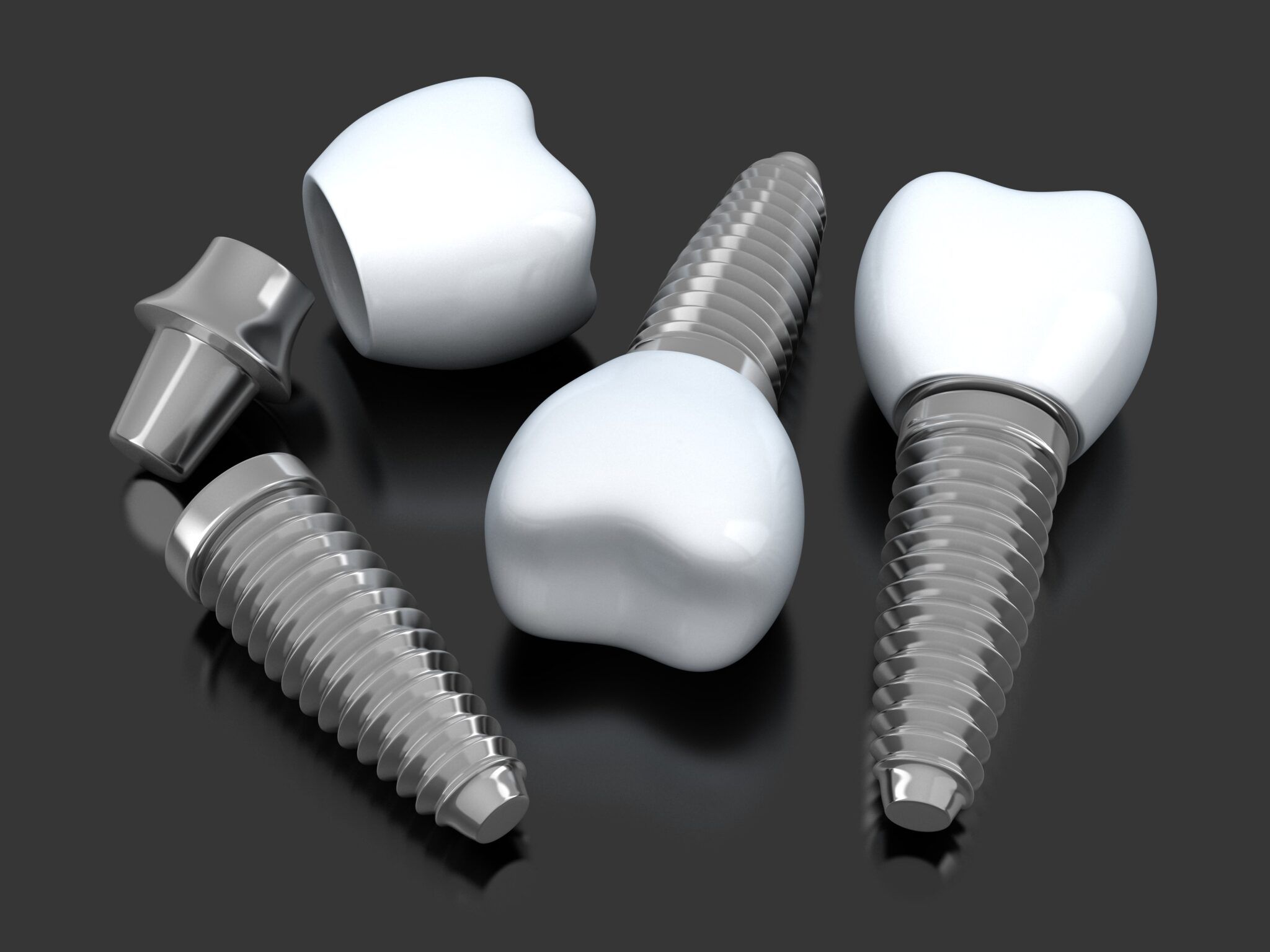 Different Types of Dental Abutments and Their Uses Chicago Dental