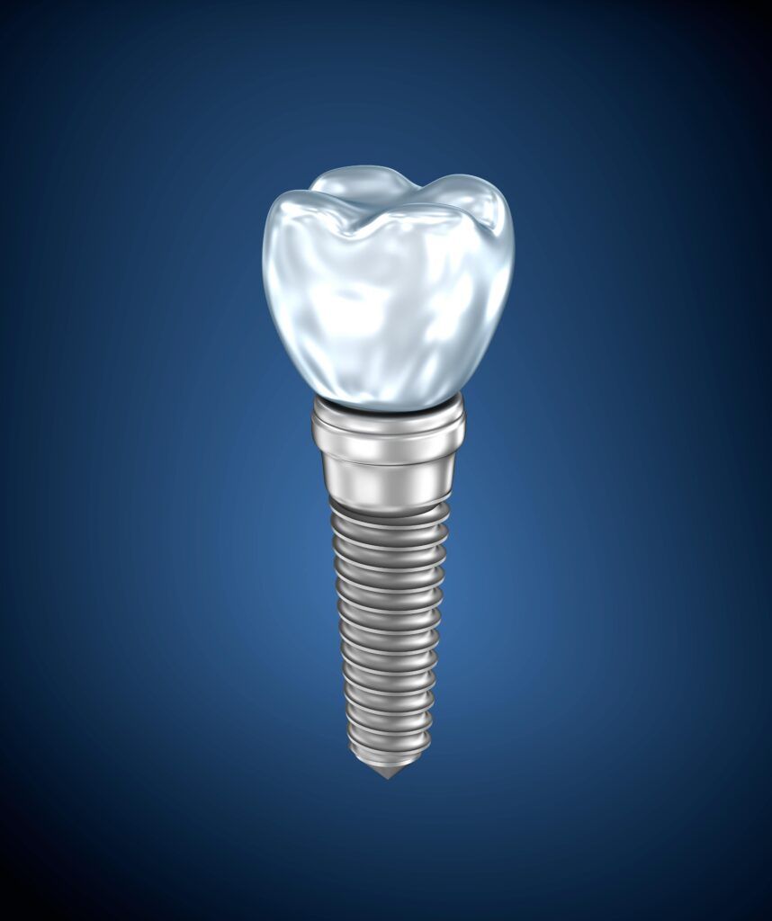 Dental titanium implant on navy blue background