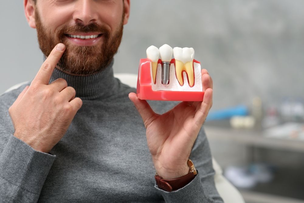 The Evolution of Dental Implants: A Look at Their History and Advancements You're