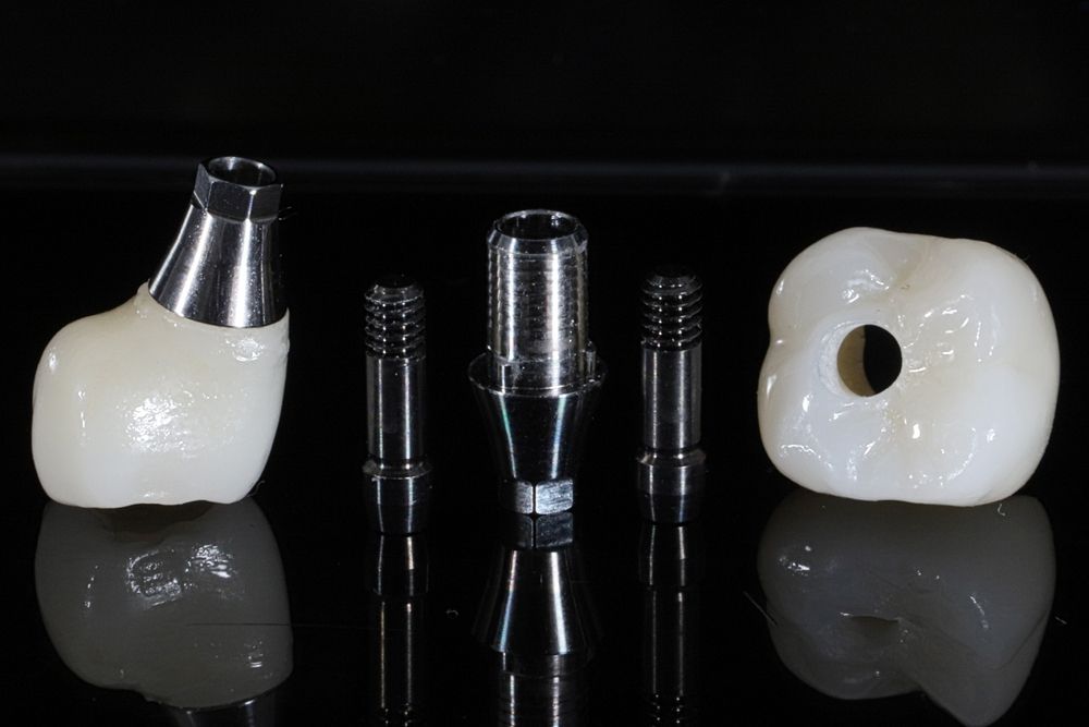 Understanding the Different Types of Implant Materials: Titanium vs. Zirconia