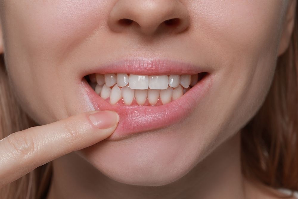 dental gums, mouth