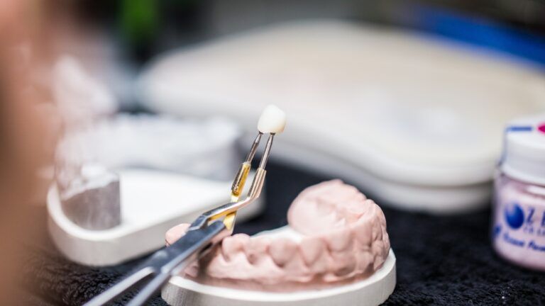 A dental technician carefully holds a crafted dental crown using tweezers over a model of teeth