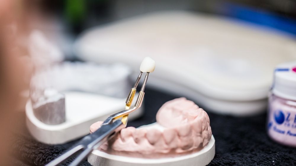 A dental technician carefully holds a crafted dental crown using tweezers over a model of teeth