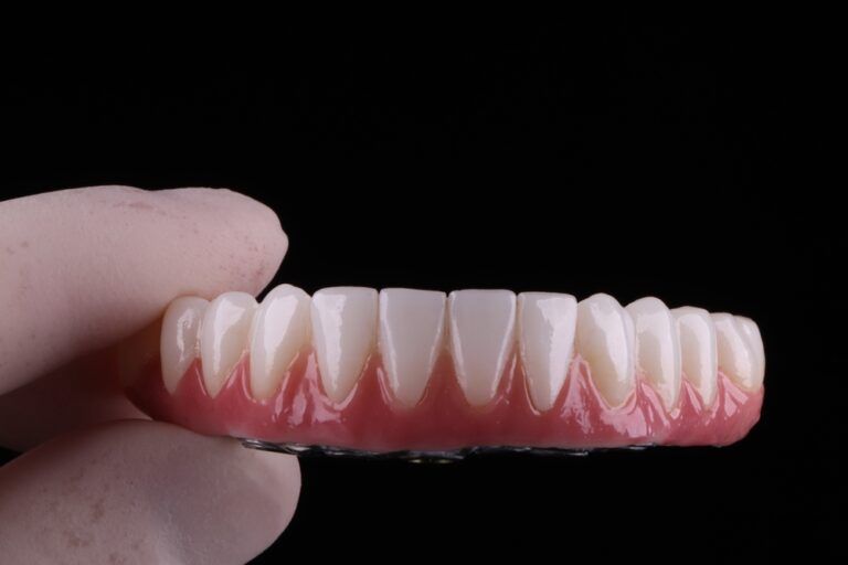 Zirconia, crown, implants, titanium, prosthetics, dental laboratory,