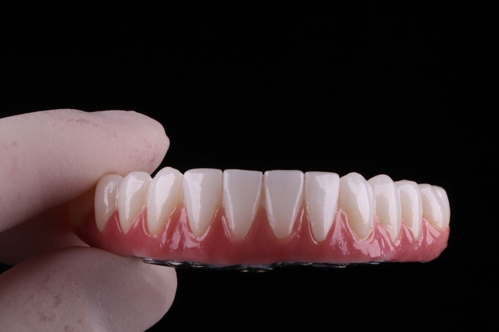 Zirconia, crown, implants, titanium, prosthetics, dental laboratory,