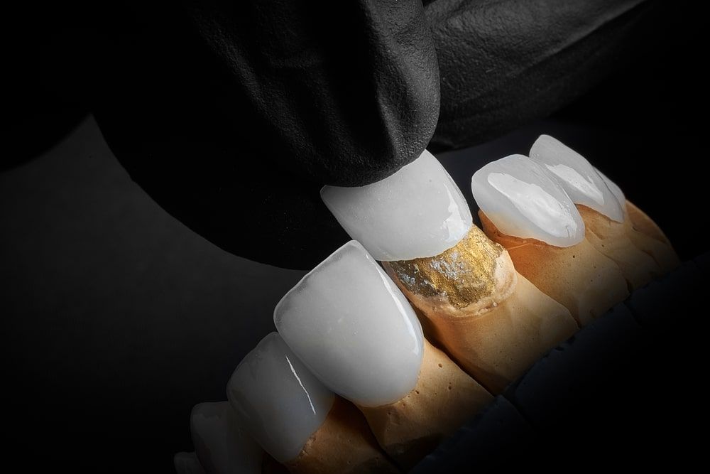 Cosmetic dentistry enhances the appearance of teeth, gums, and smiles. Procedures include teeth whitening, veneers, bonding, and implants