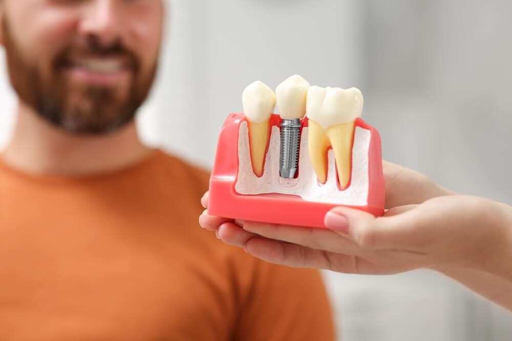 Doctor with educational model of dental implant
