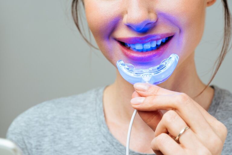 A young woman is engaged in home teeth whitening