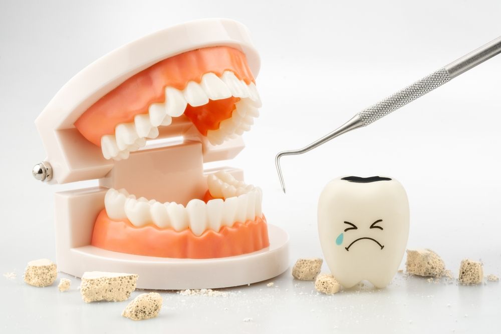 Teeth model with dental plaque tool ,Concept Dental care cleaning bacterial plaque and scaling tartar