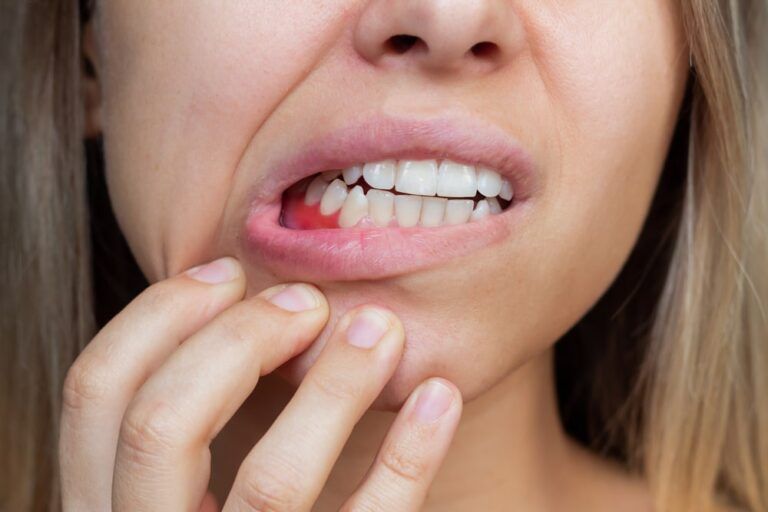 Gum inflammation. Close-up of a young woman showing bleeding gums. Dentistry, dental care
