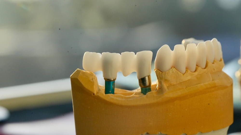Dental model shot from a close distance with a macro lens.