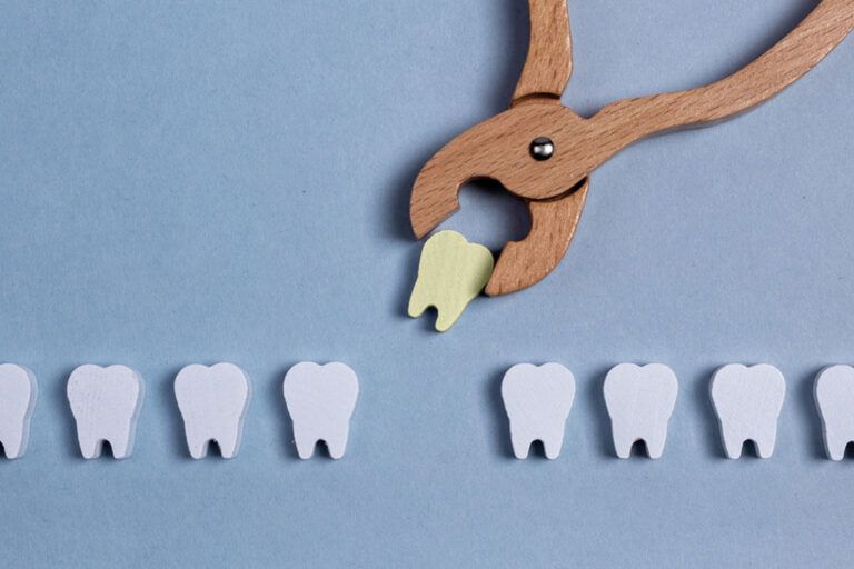 Surgical extraction of sick bad tooth with forceps