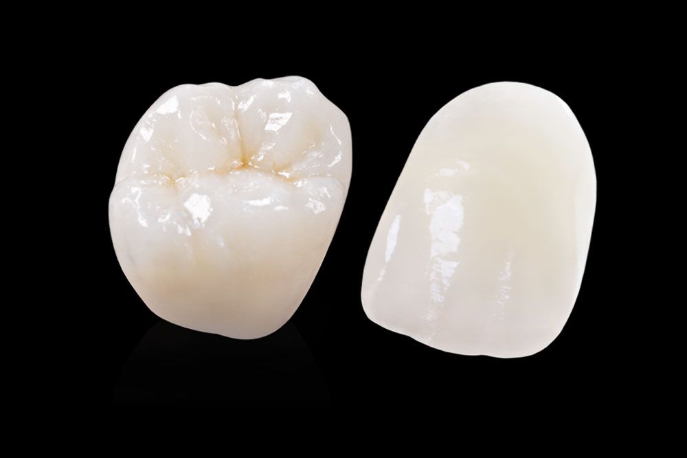 Dental crown models