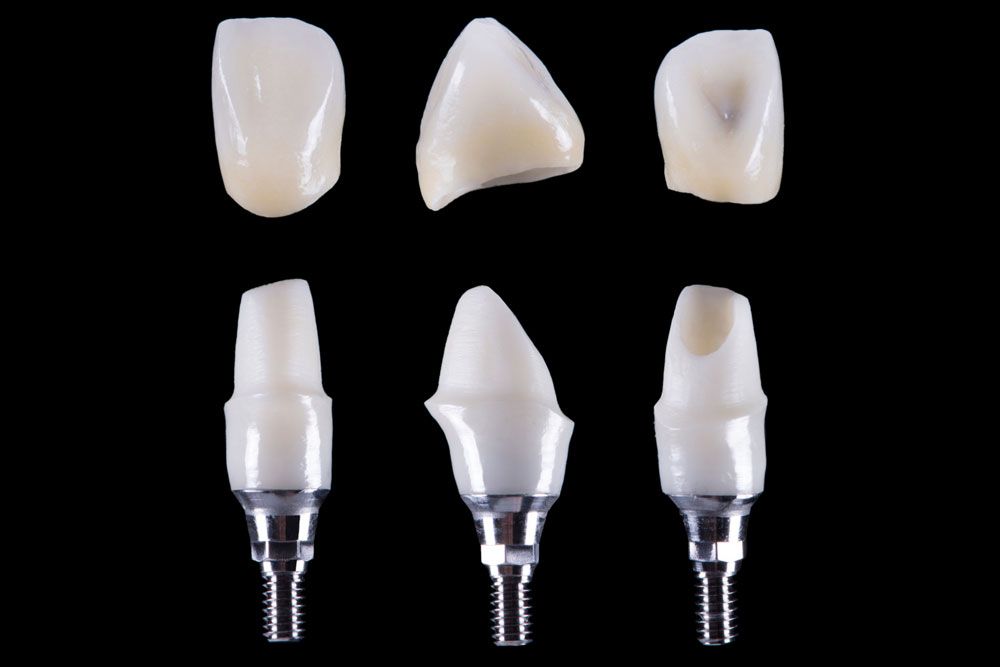 Zirconium crown and zirconium hybrid abutment