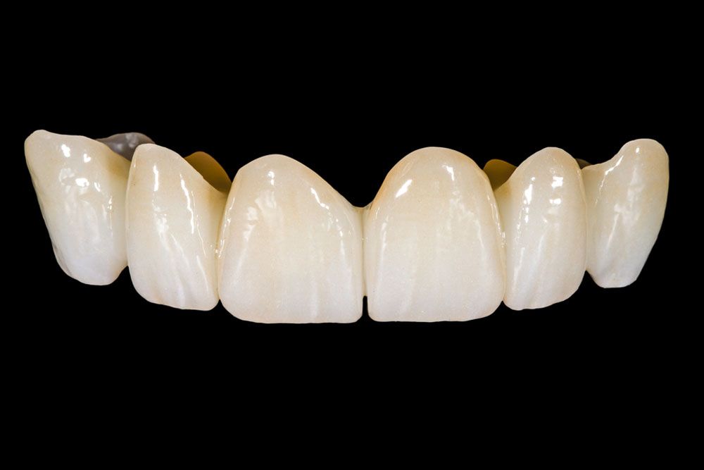 Dental ceramic bridge on isolated