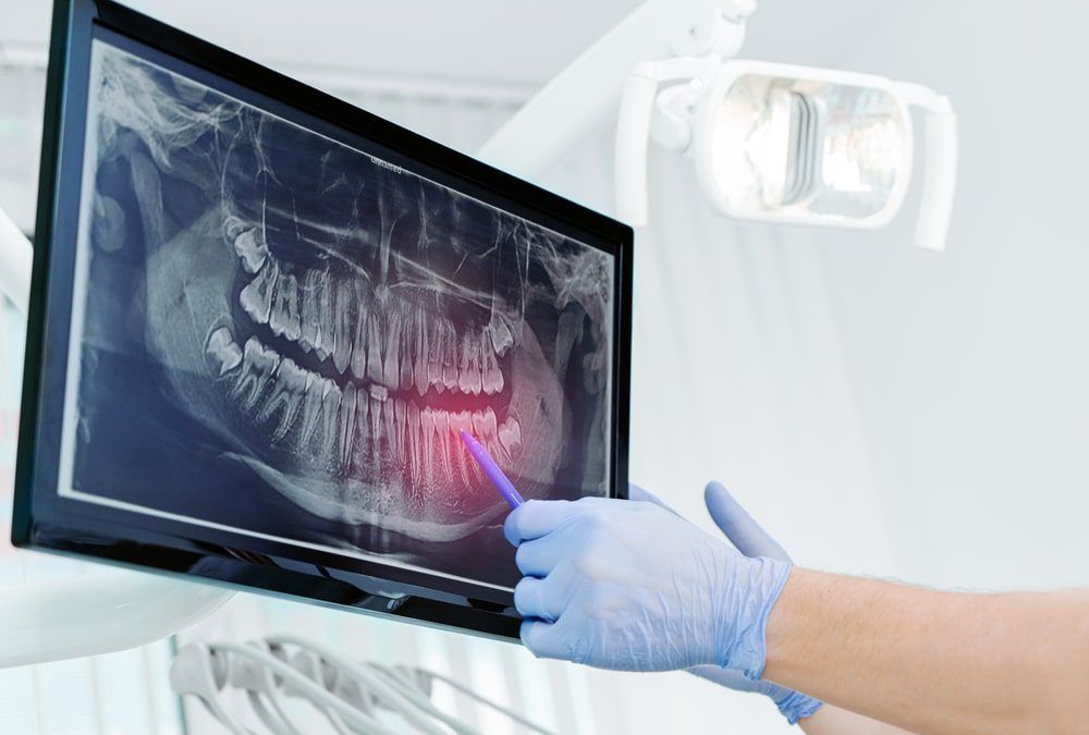 Dentist Showing Xray